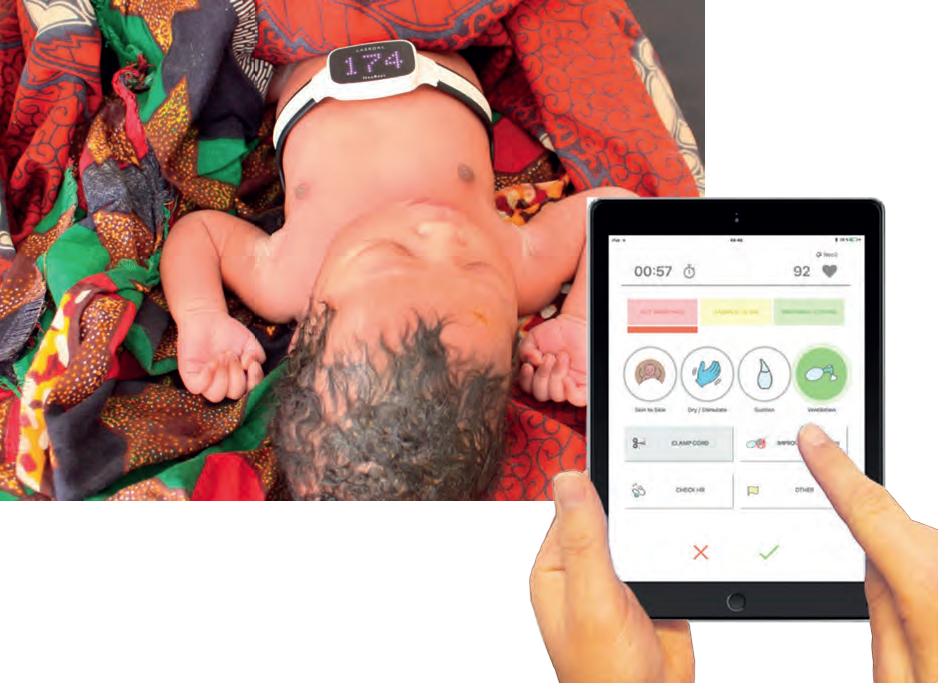 A baby with a heartmonitor showing the pulse and a tablet with The Liveborn app